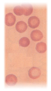 Red blood cell smear